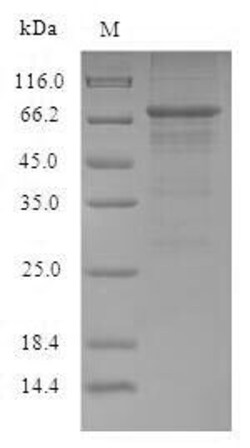 Biomatik Corporation Recombinant Influenza A virus Nucleoprotein (NP),