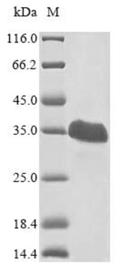 Biomatik Corporation Recombinant Human Von Hippel-Lindau disease tumor