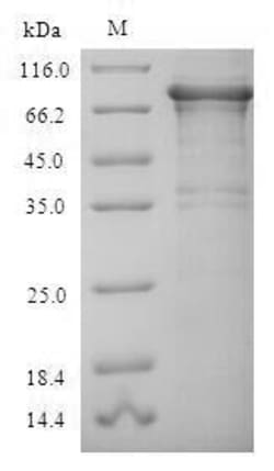 Biomatik Corporation Recombinant Human Replication protein A 70kDa DNA-binding