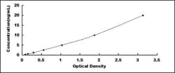 Biomatik Corporation Human Tubulin Alpha 1A (TUBa1A) ELISA Kit, Quantity: