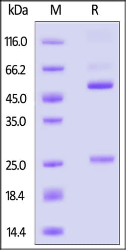 ACROBiosystems Glycoprotein E VZV 100ug, Quantity: Each of 1