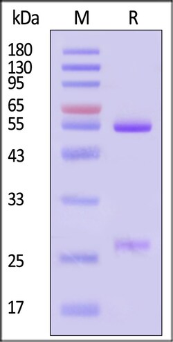 ACROBiosystems Glycoprotein E VZV 25ug, Quantity: Each of 1