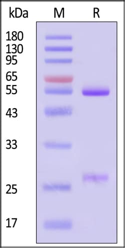 ACROBiosystems Glycoprotein E VZV 200ug, Quantity: Each of 1