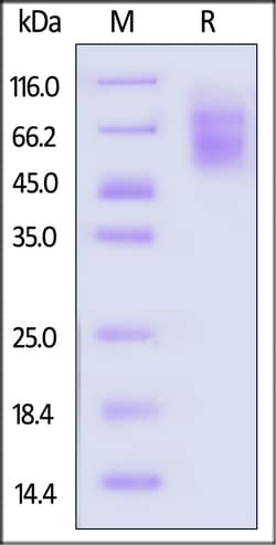ACROBiosystems&nbsp;Human TIM-4 Protein His Tag