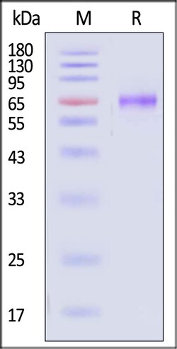 ACROBiosystems Human TIM-3 25ug, Quantity: Each of 1