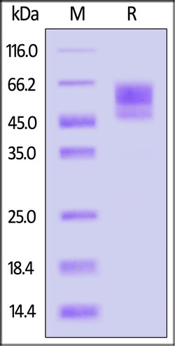 ACROBiosystems Human TGF-beta RII 100ug, Quantity: Each of 1