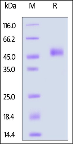ACROBiosystems Human TGF-beta RI 100ug, Quantity: Each of 1