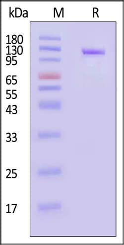 ACROBiosystems Human Transferrin R 200ug, Quantity: Each of 1