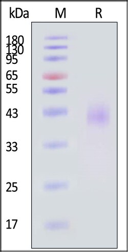 ACROBiosystems Human TEM8/ANTXR1 200ug, Quantity: Each of 1