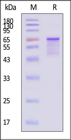 ACROBiosystems Human Tau 50ug, Quantity: Each of 1