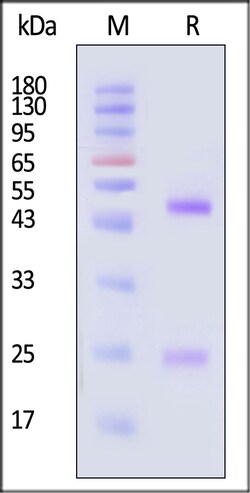 ACROBiosystems Mouse Spike RBD 100ug, Quantity: Each of 1