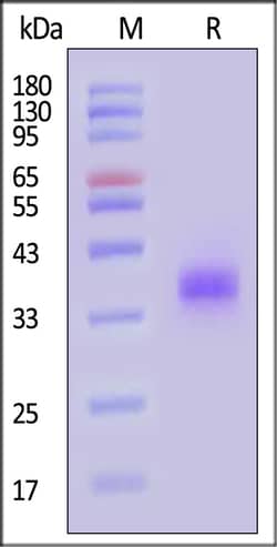ACROBiosystems SARS-CoV-2 Spike RBD 25ug, Quantity: Each of 1