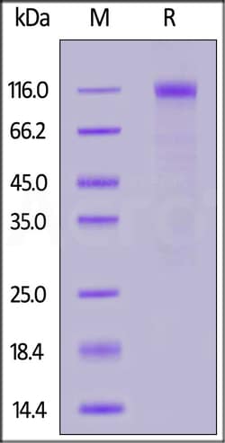 ACROBiosystems SARS-CoV-2 Spike S1 100ug, Quantity: Each of 1