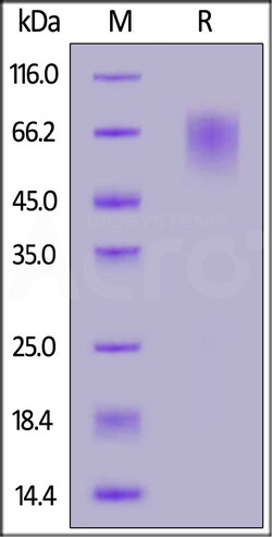 ACROBiosystems SARS-CoV-2 Spike NTD 25ug, Quantity: Each of 1