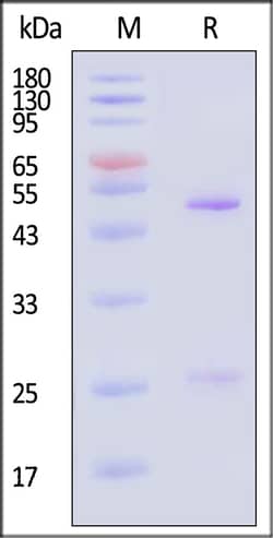 ACROBiosystems Mouse RSV-post-F0 100ug, Quantity: Each of 1