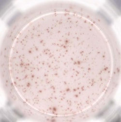 ACROBiosystems Mouse IFN-gamma 96tests, Quantity: Each of 1