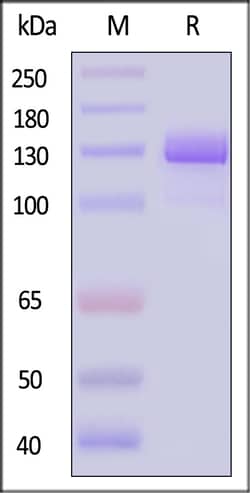 ACROBiosystems Human PSMA 200ug, Quantity: Each of 1