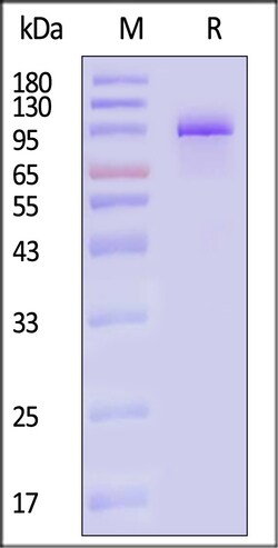 ACROBiosystems Cynomolgus PSMA 200ug, Quantity: Each of 1