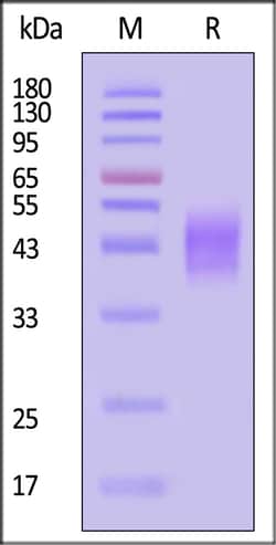 ACROBiosystems Mouse PD-L1 25ug, Quantity: Each of 1