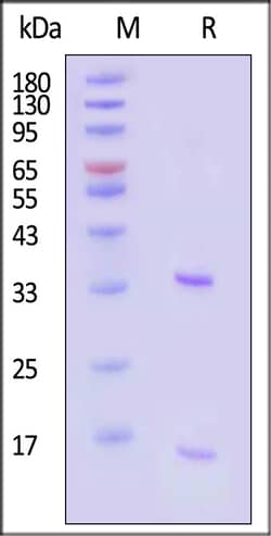 ACROBiosystems&nbsp;Human PCSK9 Protein His Tag