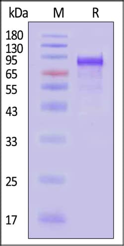 ACROBiosystems Neuraminidase NA 100ug, Quantity: Each of 1