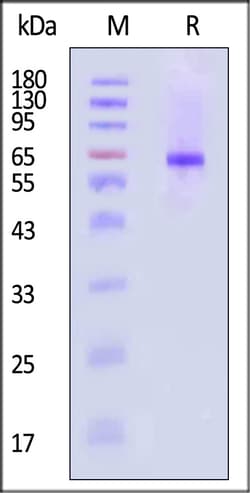 ACROBiosystems Neuraminidase NA 100ug, Quantity: Each of 1
