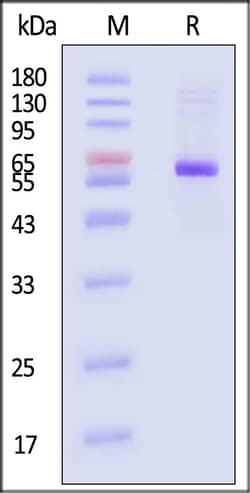 ACROBiosystems Neuraminidase NA 100ug, Quantity: Each of 1