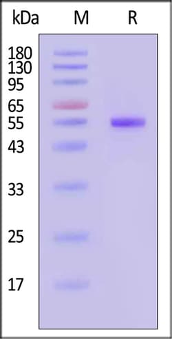 ACROBiosystems Neuraminidase NA 100ug, Quantity: Each of 1