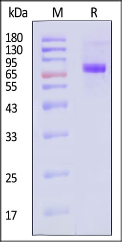 ACROBiosystems Neuraminidase NA 100ug, Quantity: Each of 1