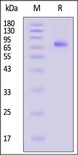 ACROBiosystems Neuraminidase NA 100ug, Quantity: Each of 1