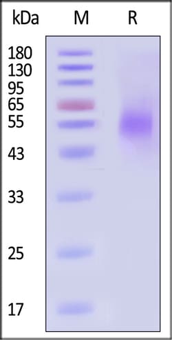 ACROBiosystems Mouse NKG2A CD94 100ug, Quantity: Each of 1