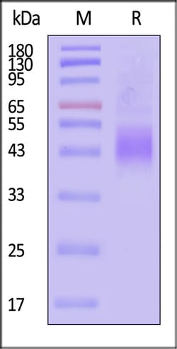 ACROBiosystems Human NKG2A CD94 100ug, Quantity: Each of 1