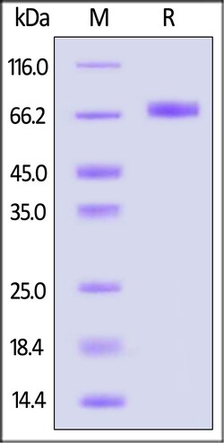 ACROBiosystems Mouse Mesothelin 100ug, Quantity: Each of 1