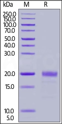 ACROBiosystems Human MIF 25ug, Quantity: Each of 1