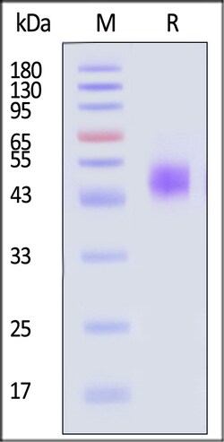 ACROBiosystems Human MICB Protein His Tag, Quantity: Each of 1