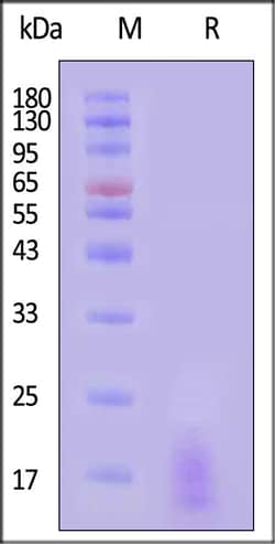 ACROBiosystems Cynomolgus LY6G6D 100ug, Quantity: Each of 1