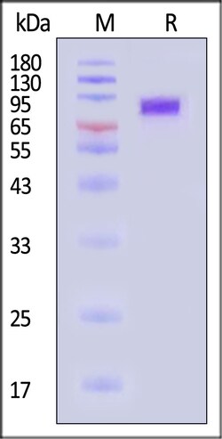 ACROBiosystems Human LIV-1 200ug, Quantity: Each of 1