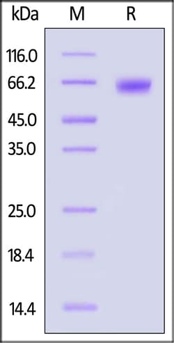 ACROBiosystems Human LILRB2 25ug, Quantity: Each of 1