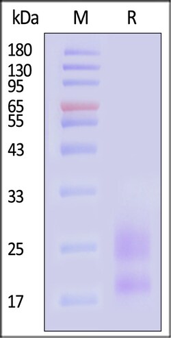 ACROBiosystems Cynomolgus KLRG1 100ug, Quantity: Each of 1