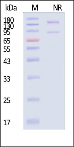 ACROBiosystems Integrin alpha V beta 3 100ug, Quantity: Each of 1