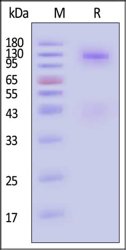 ACROBiosystems Human Insulin R 200ug, Quantity: Each of 1