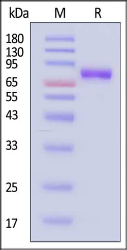 ACROBiosystems Mouse IL-6 R alpha 100ug, Quantity: Each of 1
