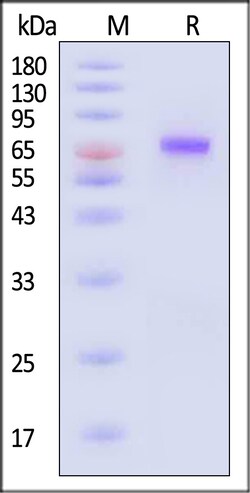 ACROBiosystems Human IL-21 R 25ug, Quantity: Each of 1
