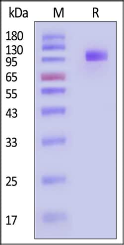 ACROBiosystems Human IL-35 R His Tag, Quantity: Each of 1