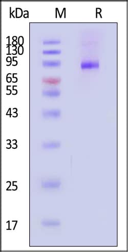 ACROBiosystems Human IL-12 R beta 2 25ug, Quantity: Each of 1