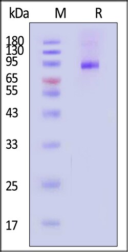 ACROBiosystems Human IL-12 R beta 2 200ug, Quantity: Each of 1
