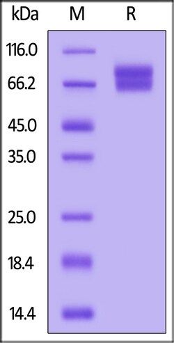 ACROBiosystems IL-21 R IL-2 R gamma 100ug, Quantity: Each of 1
