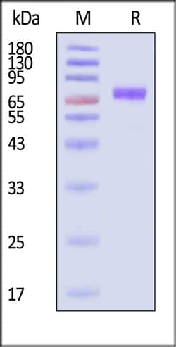 ACROBiosystems Human IL-27 Ra 100ug, Quantity: Each of 1
