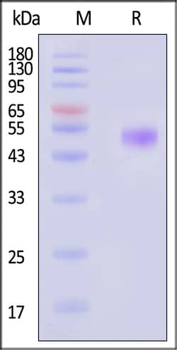 ACROBiosystems Human IL-15 20ug, Quantity: Each of 1