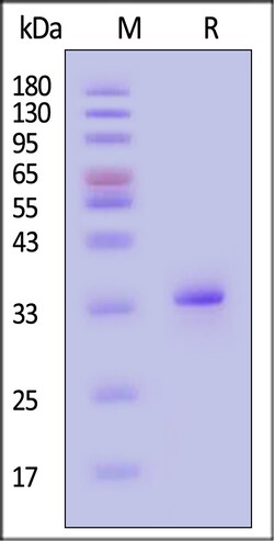 ACROBiosystems Human IGFBP-2 Protein His Tag, Quantity: Each of 1